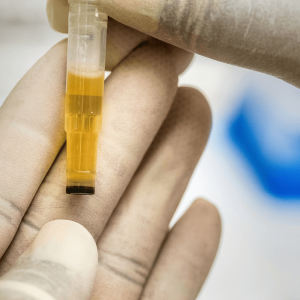 a urine drug test
